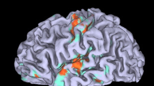 Il cervello invecchia in almeno cinque modi